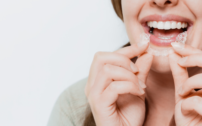 How to Keep Your Invisalign Aligners Stain-Free